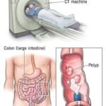 The natural rhythm of sleeping all night and at the same time helping to burn fat