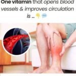 Navigating Vitamin Habits: Understanding Stroke Risk for Older Adults and Brain Health