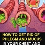 Cholesterol: 5 symptoms that warn you it’s too high(1 / 2