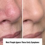 This natural recipe will permanently remove facial hair