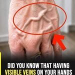 Weak or Brittle Nails: What Your Body Is Trying to Tell You
