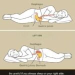 Are You Urinating a Lot at Night? Here’s Why and What You Can Do About It